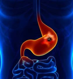Заболевания желудочно-кишечного тракта